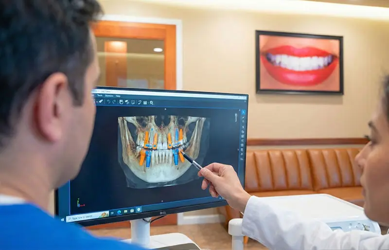 Carabelli Dental Implant